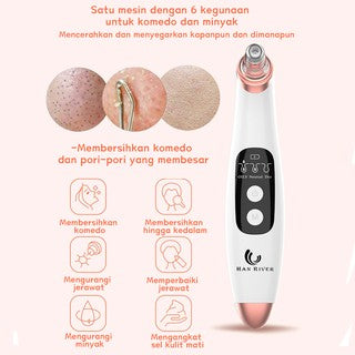 Han River Vacuum Blackhead Removal Therapy HRHTY01WT